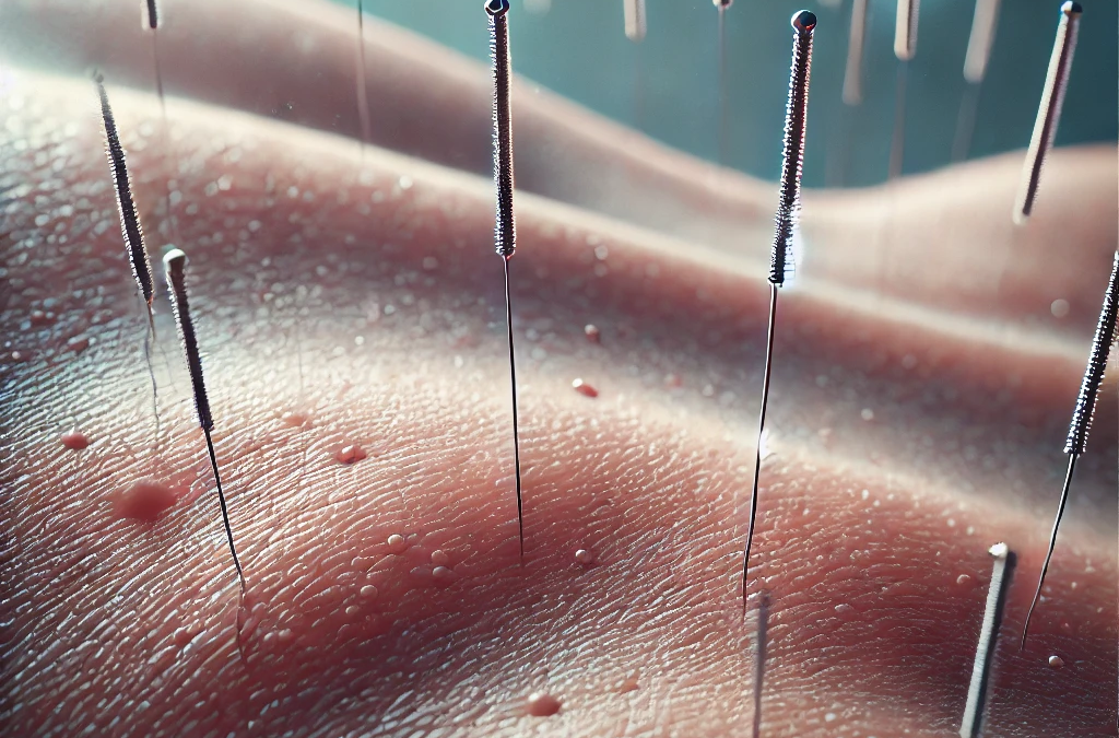 What to Expect with Your First Acupuncture Treatment